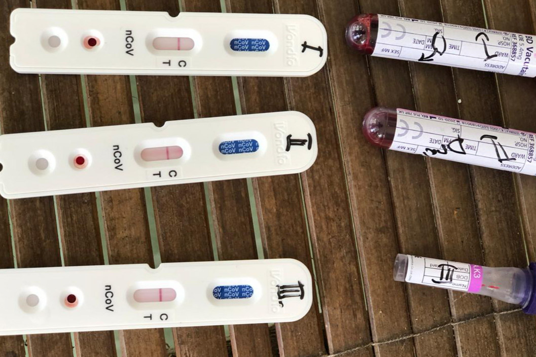 6.600 Rapid Test Didistribusikan, 492 Sudah Terpakai